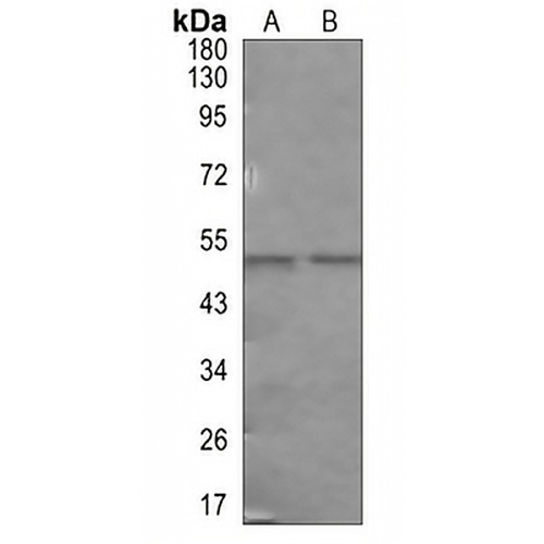 CD23 Rabbit Monoclonal Antibody(C610)