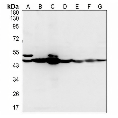 Cytokeratin 18 Rabbit Monoclonal Antibody(C612)