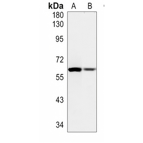 Cytokeratin 5 Rabbit Monoclonal Antibody(C613)