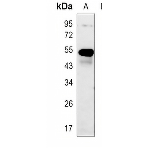 Cytokeratin 7 Rabbit Monoclonal Antibody(C614)