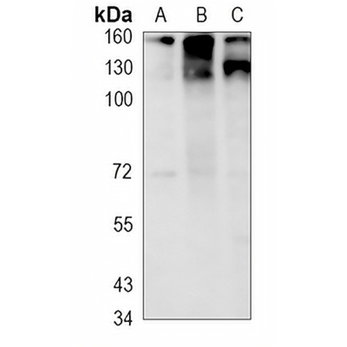 MSH6 Rabbit Monoclonal Antibody(C616)
