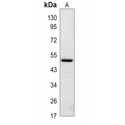 CD274 Rabbit Monoclonal Antibody(C617)