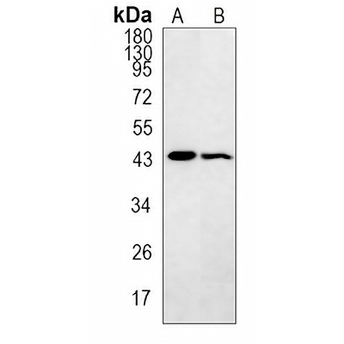 Smooth Muscle Actin Rabbit Monoclonal Antibody(C618)