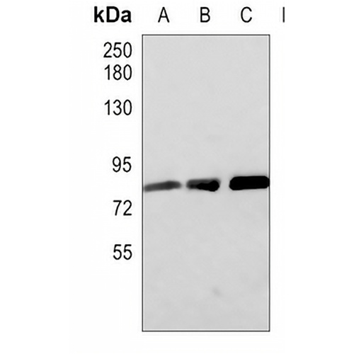 CD10 Rabbit Monoclonal Antibody(C619)