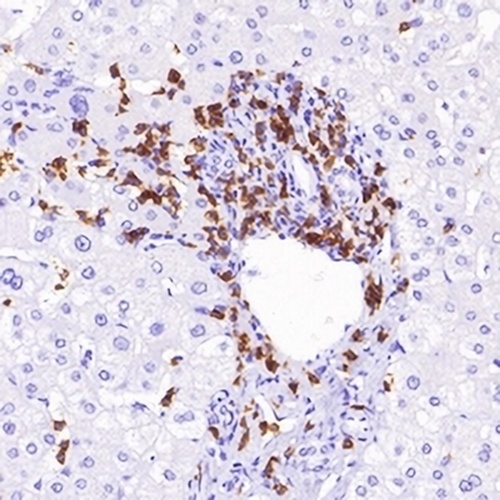 CD8a Rabbit Monoclonal Antibody(C620)