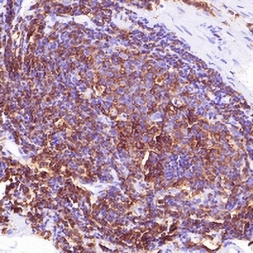 Alpha-fetoglobulin Rabbit Monoclonal Antibody(C621)