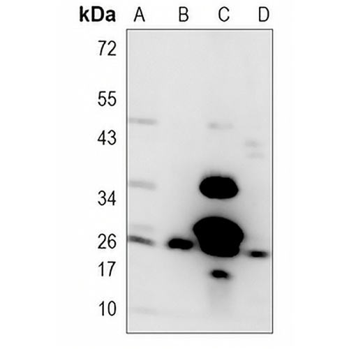 BCL2 Rabbit Monoclonal Antibody(C622)