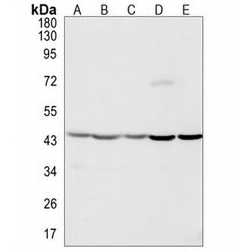 Beta-actin Rabbit Monoclonal Antibody(C623)