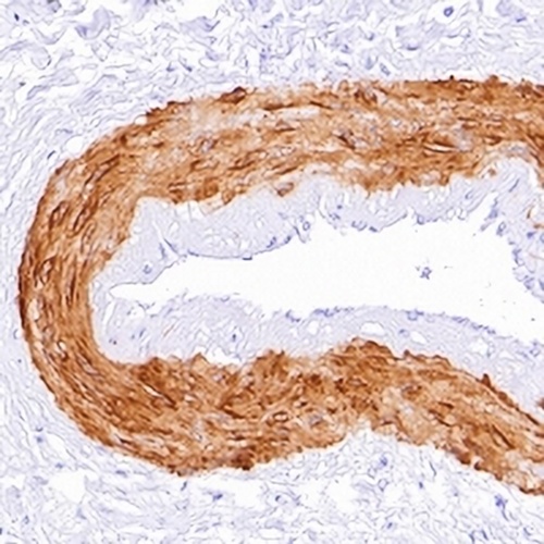 Calponin 1 Rabbit Monoclonal Antibody(C624)