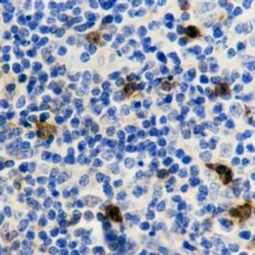CD134 Rabbit Monoclonal Antibody(C625)