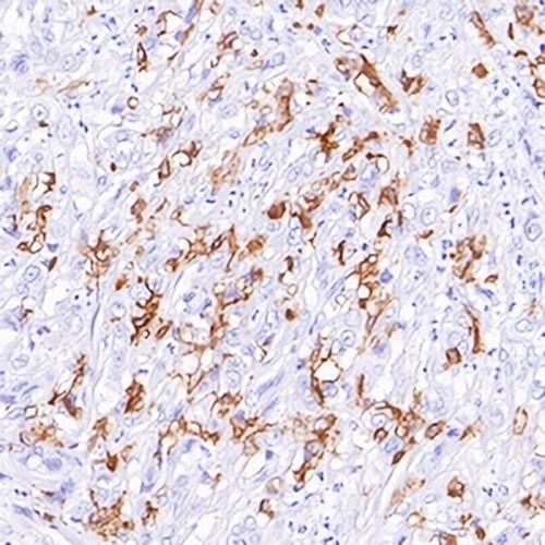 CD1a Rabbit Monoclonal Antibody(C626)