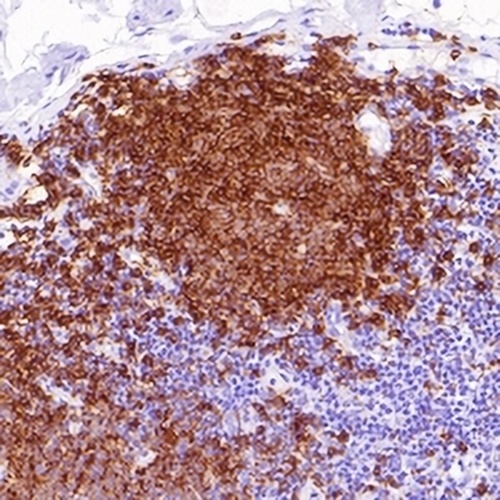 CD20 Rabbit Monoclonal Antibody(C627)