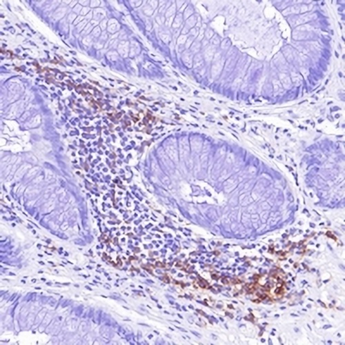 CD4 Rabbit Monoclonal Antibody(C628)
