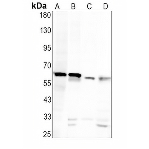 Keratin 6 Rabbit Monoclonal Antibody(C629)