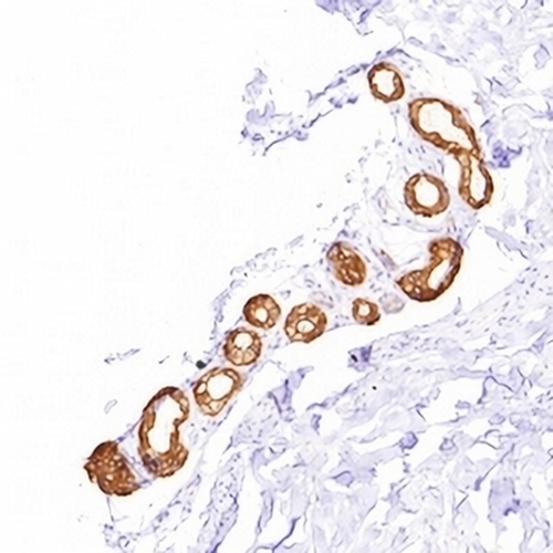 Cytokeratin 8 Rabbit Monoclonal Antibody(C630)