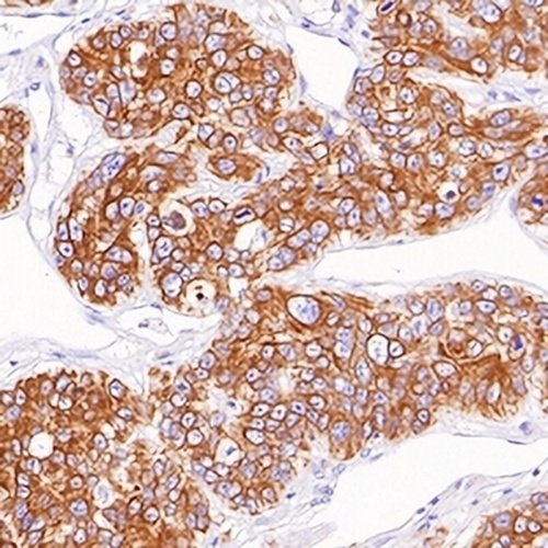 Gi24 Rabbit Monoclonal Antibody(C631)
