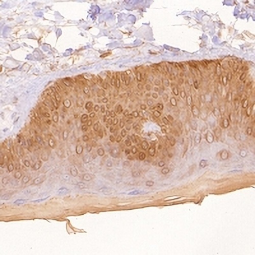 Cytokeratin 5 Rabbit Monoclonal Antibody(C632)