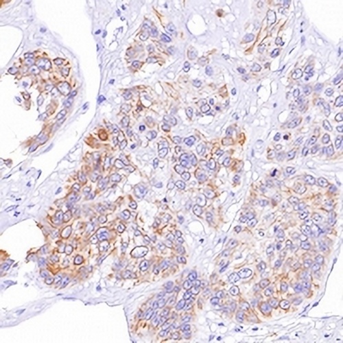 CD103 Rabbit Monoclonal Antibody(C633)
