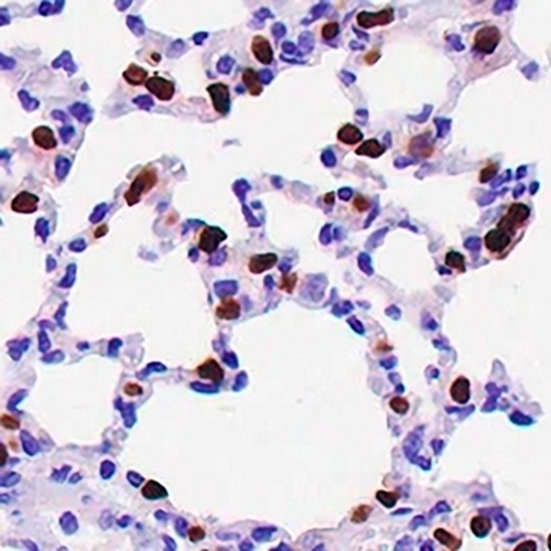NKX2-1 Rabbit Monoclonal Antibody(C634)