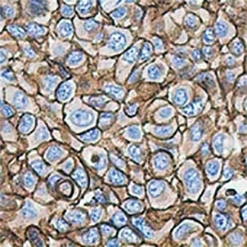 HER2 Rabbit Monoclonal Antibody(C635)