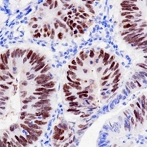 p53 Rabbit Monoclonal Antibody(C636)