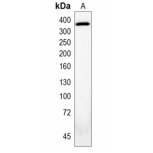 Ki67 Rabbit Monoclonal Antibody(C637)