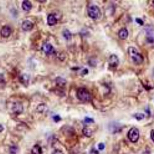 ALDH1A1 Rabbit Monoclonal Antibody(C639)