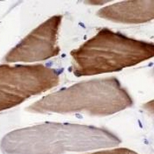 Alpha-crystallin B Rabbit Monoclonal Antibody(C641)