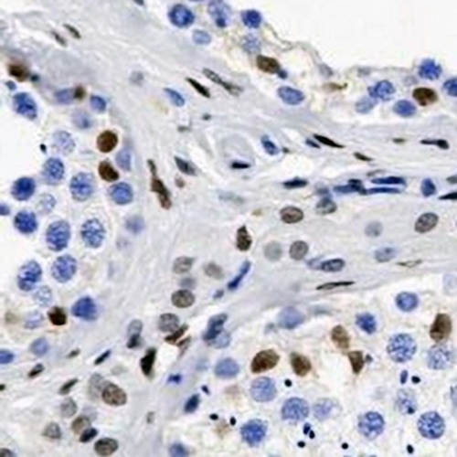 Androgen Receptor Rabbit Monoclonal Antibody(C642)
