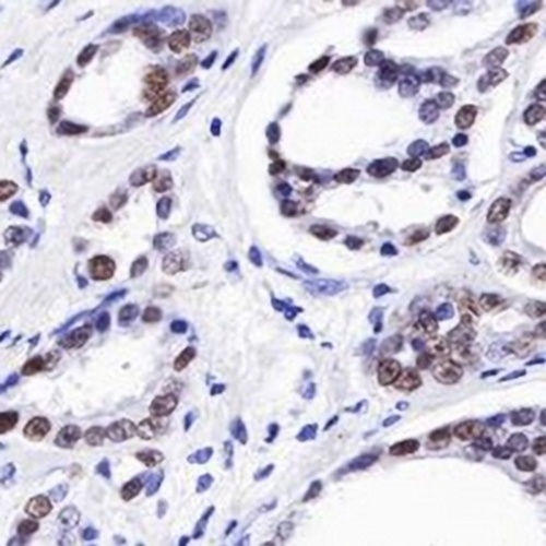 Androgen Receptor Rabbit Monoclonal Antibody(C643)