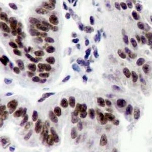 ATM Rabbit Monoclonal Antibody(C644)