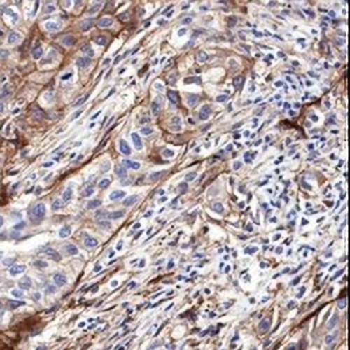 CD276 Rabbit Monoclonal Antibody(C645)