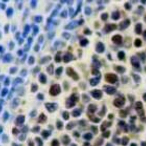 BCL6 Rabbit Monoclonal Antibody(C648)