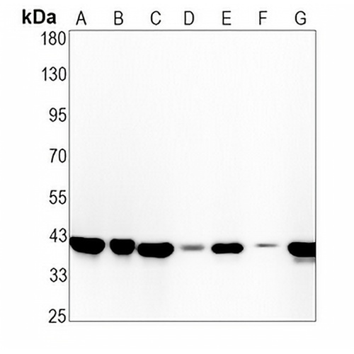 Beta-actin Rabbit Monoclonal Antibody(C649)
