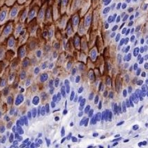 LYPD3 Rabbit Monoclonal Antibody(C650)