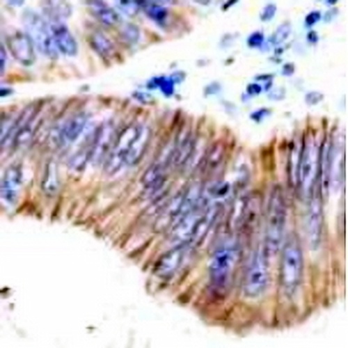 LI Cadherin Rabbit Monoclonal Antibody(C652)