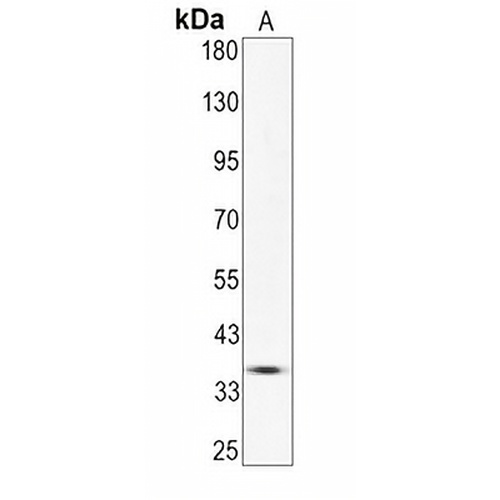 Calponin 1 Rabbit Monoclonal Antibody(C655)