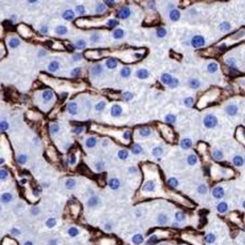 Caveolin 1 Rabbit Monoclonal Antibody(C657)