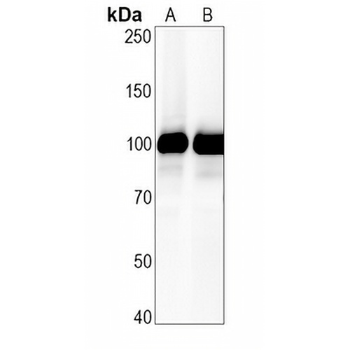 CD10 Rabbit Monoclonal Antibody(C658)