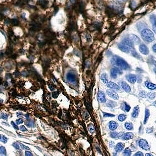 CD13 Rabbit Monoclonal Antibody(C661)