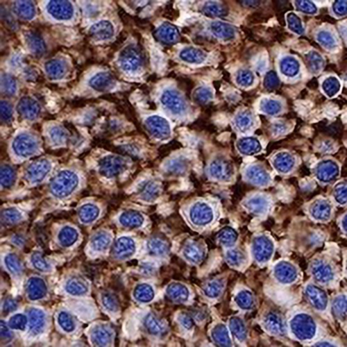 CD138 Rabbit Monoclonal Antibody(C662)