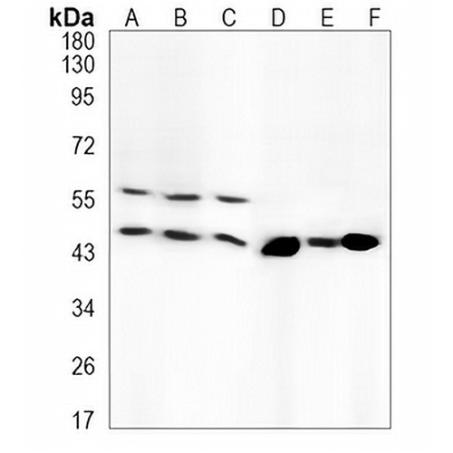 CD14 Rabbit Monoclonal Antibody(C663)