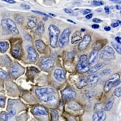 CD15 Rabbit Monoclonal Antibody(C664)