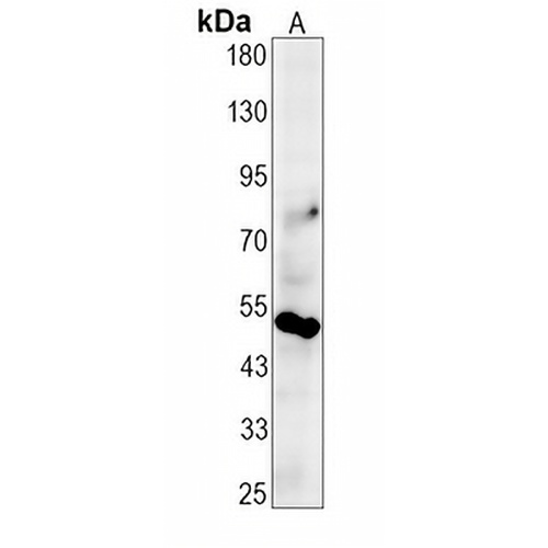 CD16 Rabbit Monoclonal Antibody(C666)