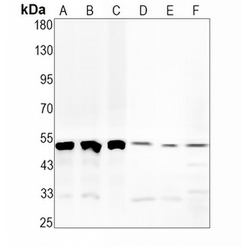 CD16 Rabbit Monoclonal Antibody(C667)