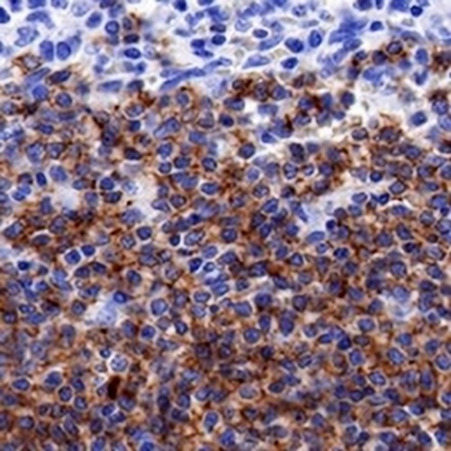 CD19 Rabbit Monoclonal Antibody(C668)