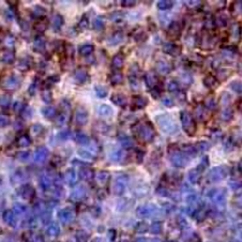 CD2 Rabbit Monoclonal Antibody(C669)
