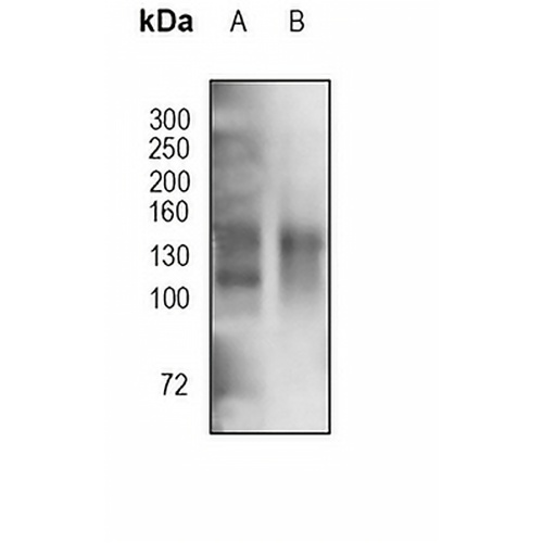 CD21 Rabbit Monoclonal Antibody(C670)