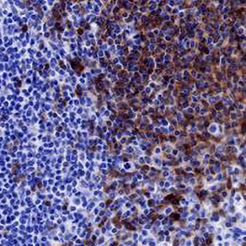 CD22 Rabbit Monoclonal Antibody(C671)