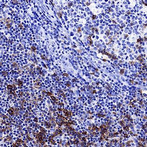 CD278 Rabbit Monoclonal Antibody(C672)